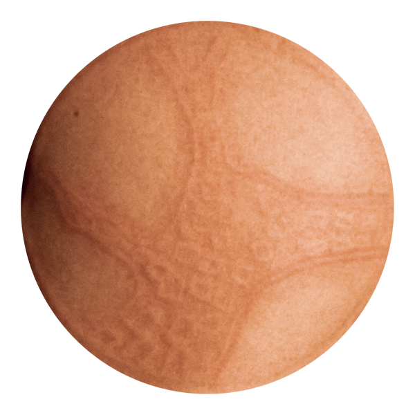 photo of virus v06-011515