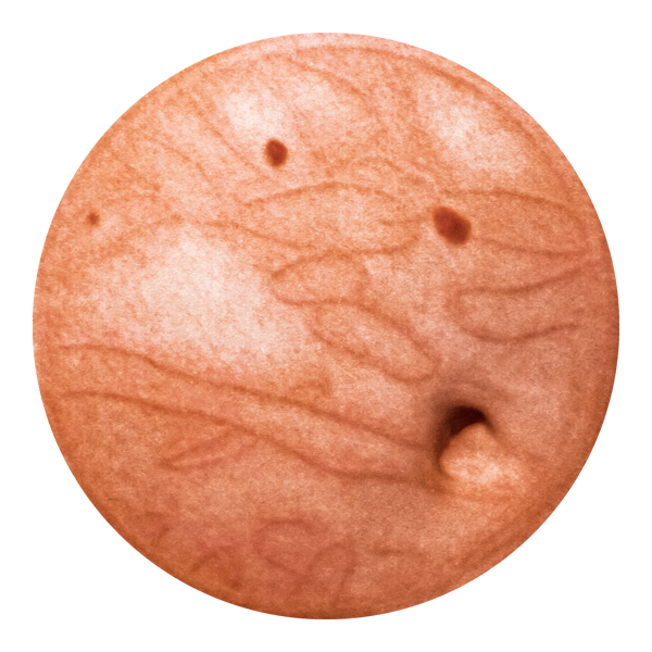 photo of virus v06-011415